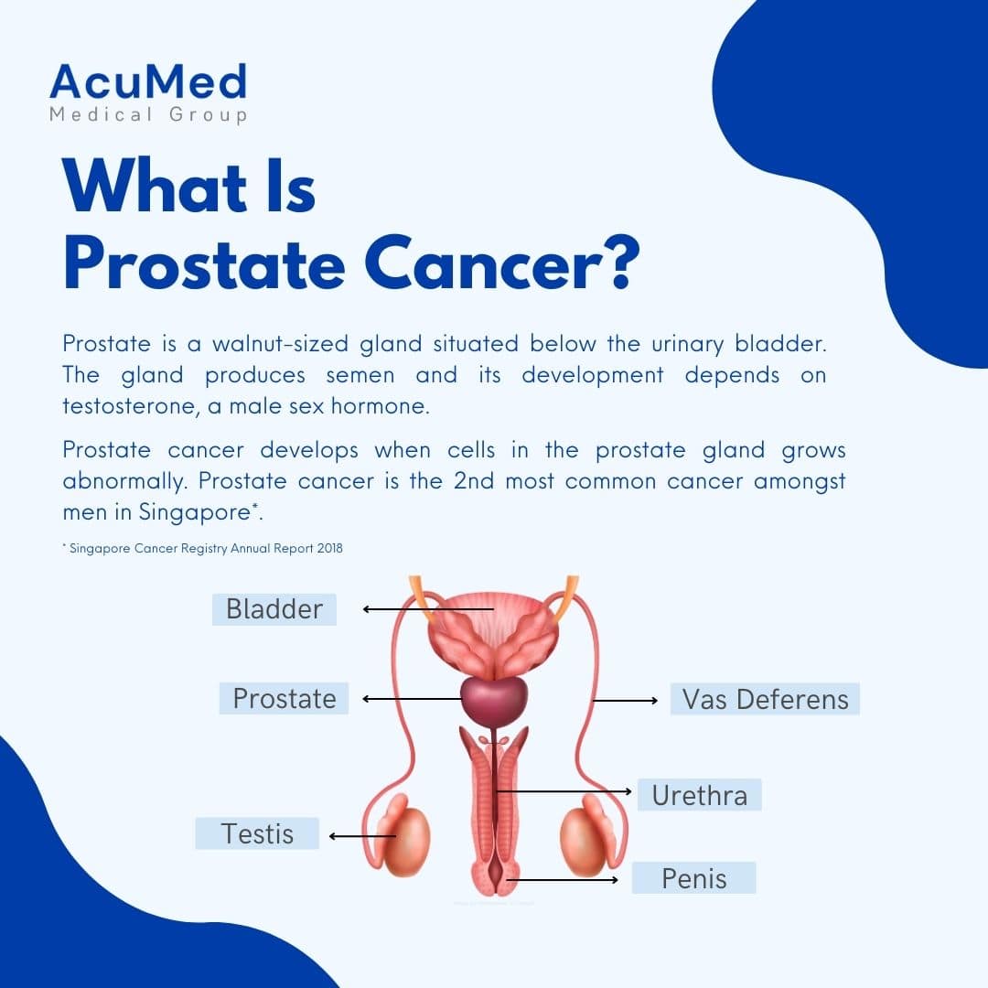 Learn More About Prostate Cancer And The Warning Signs Acumed